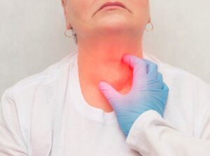 Cáncer de Cabeza y Cuello